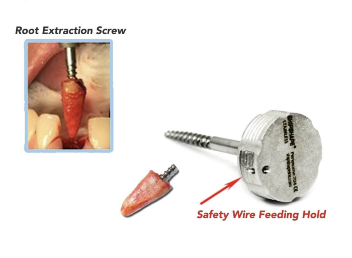 Implant Titanium Flex Periotome Screw